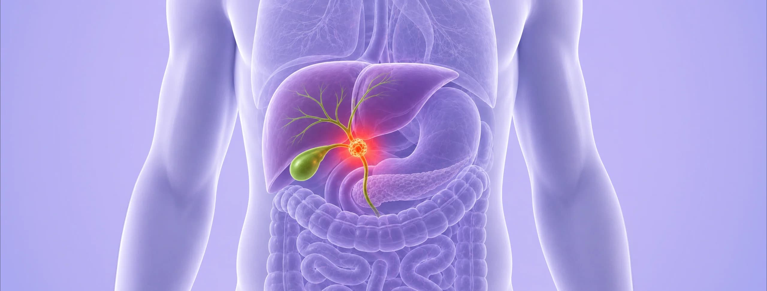Supportive Care for Every Step of Your Bile Duct Cancer Treatment