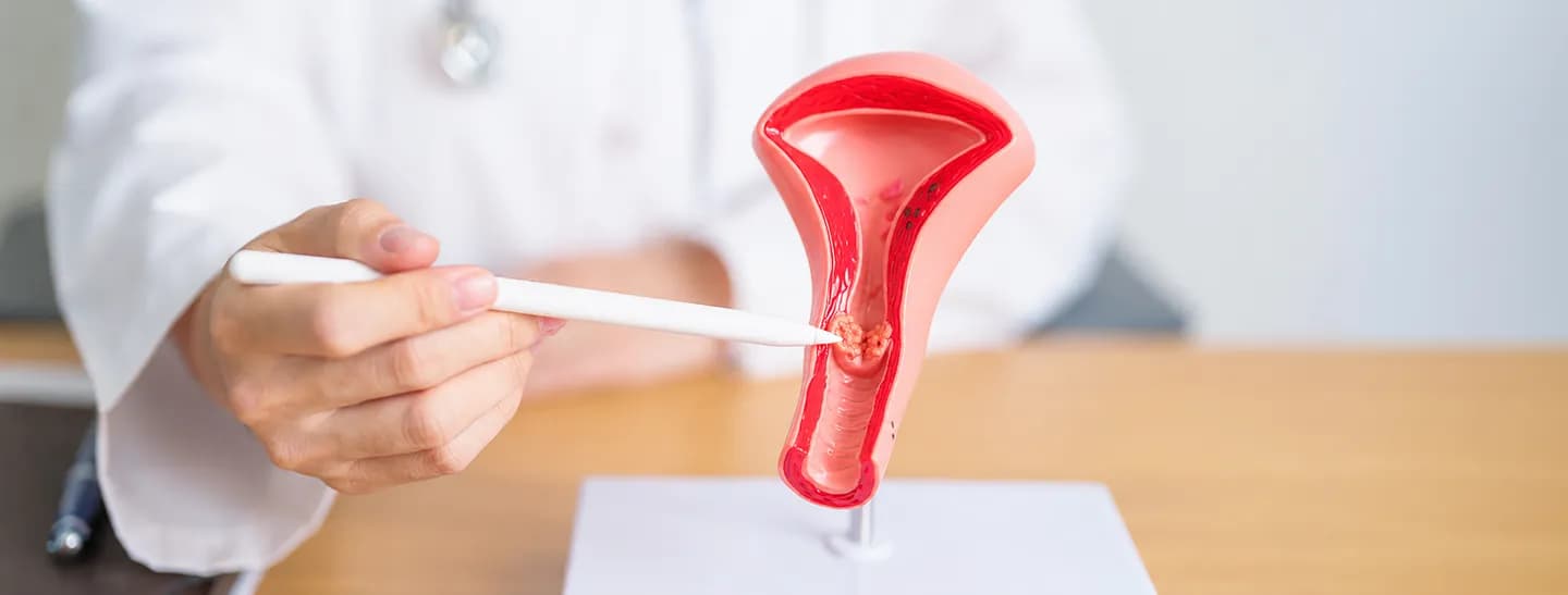 Supportive Care for Every Step of Your Cervical Cancer Treatment