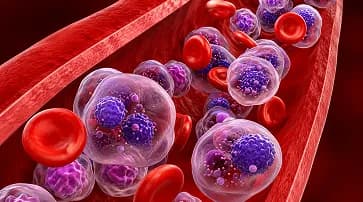 CAR T-cell therapy: