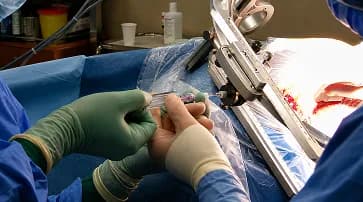Why Biopsy Planning Matters