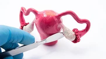 Ovarian Management