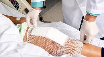 Limb-Sparing Surgery