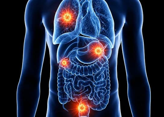 Cancer healer