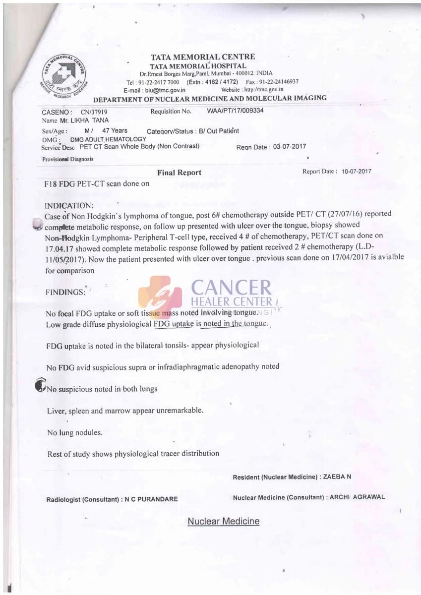 Peripheral T-Cell Lymphoma of the Tongue Case Study: No Metabolically Active Disease on Follow-Up PET-CT — medical report 1