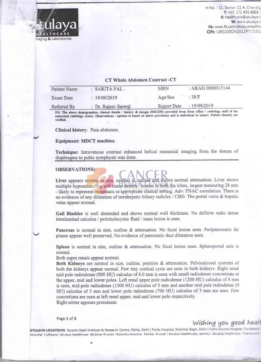 Rectal Cancer with Hepatic Metastases — Major Reduction in Primary Mass and Liver Lesions Documented Across Serial CT Scans — medical report 1