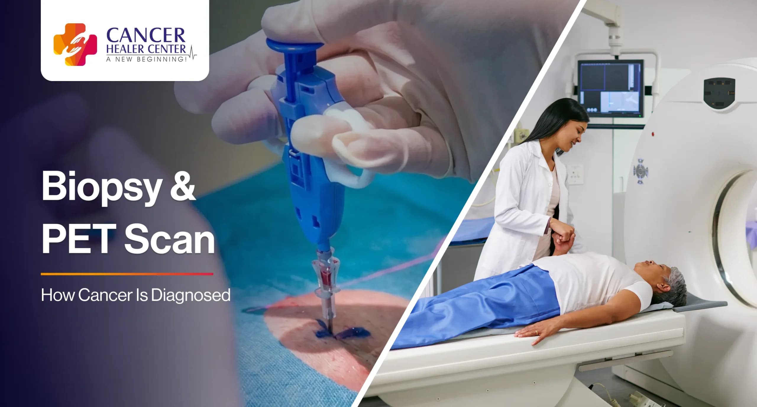 Biopsy and PET Scan – How Cancer Is Diagnosed