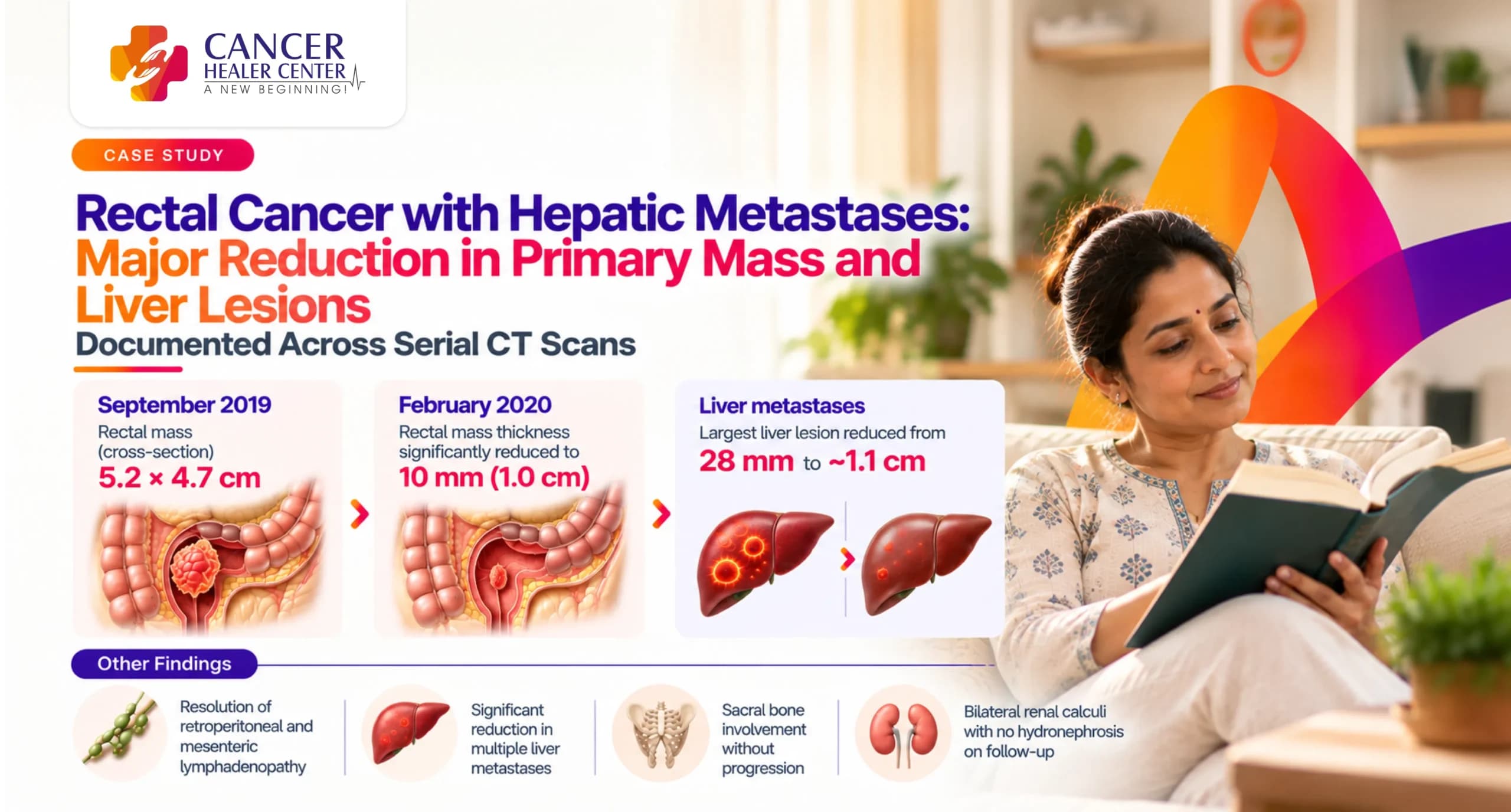 Rectal Cancer with Hepatic Metastases — Major Reduction in Primary Mass and Liver Lesions Documented Across Serial CT Scans