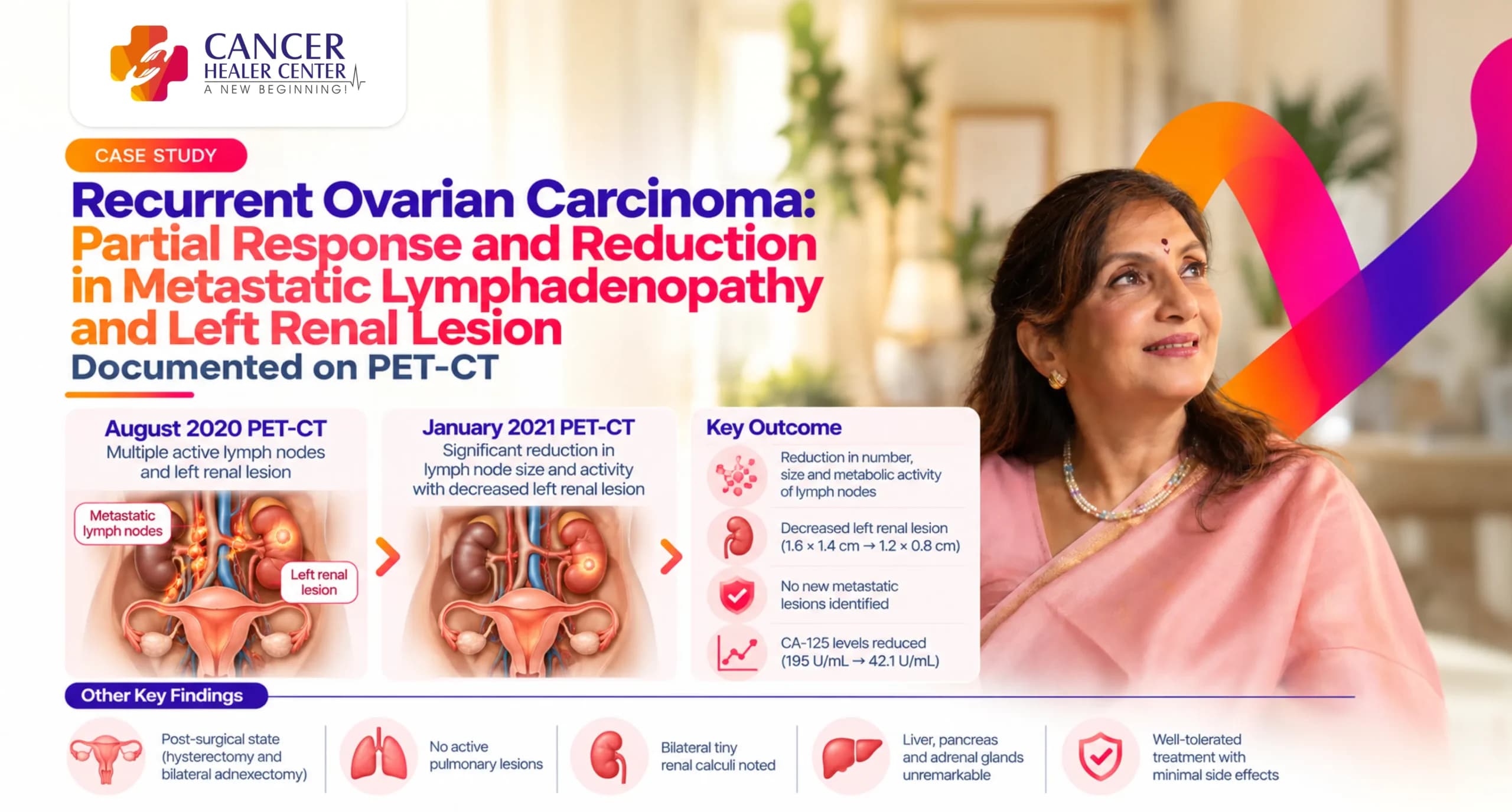 Recurrent Ovarian Carcinoma Case Study: Partial Response and Reduction in Metastatic Lymphadenopathy and Left Renal Lesion Documented on PET-CT
