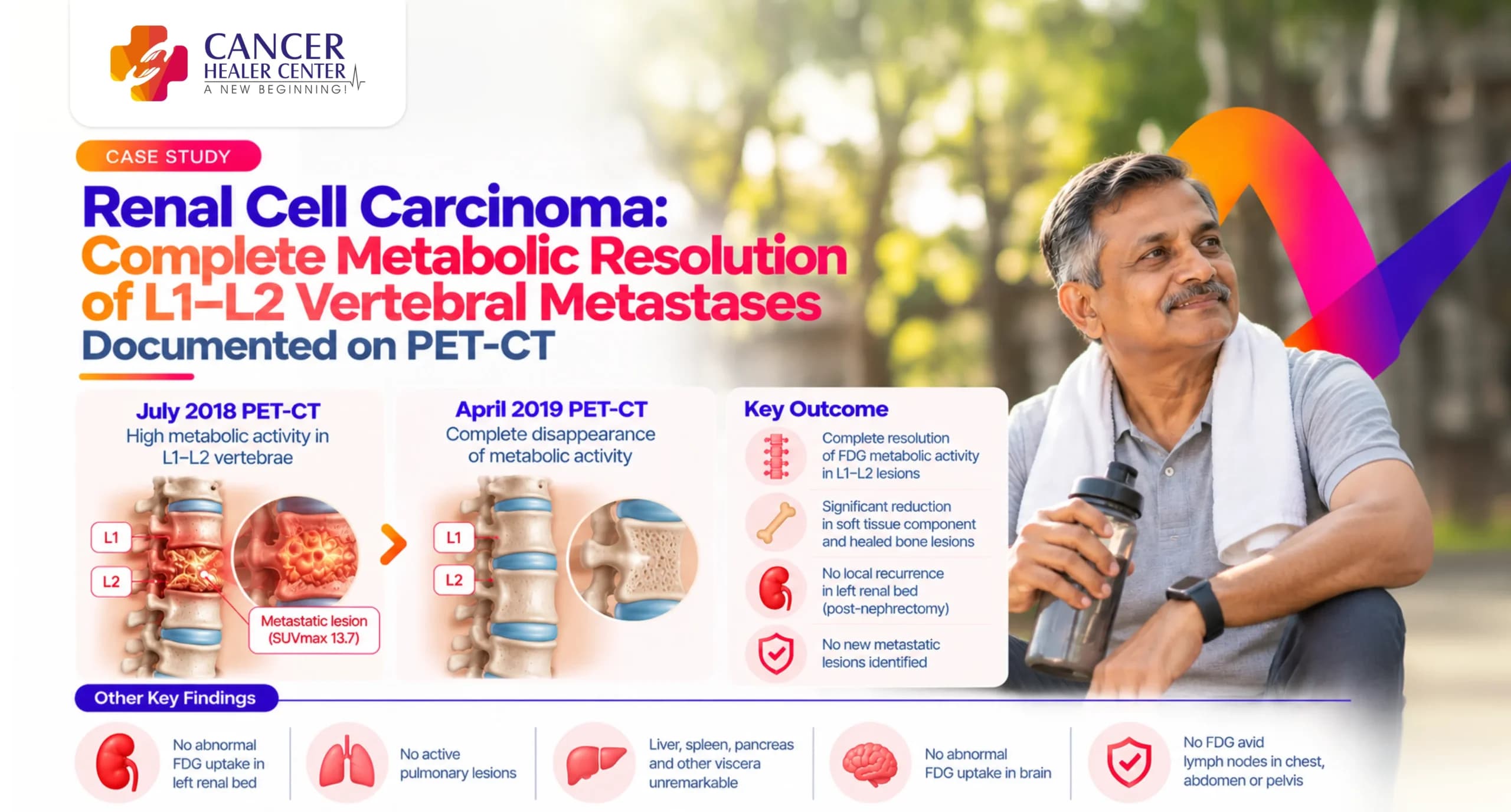 Renal Cell Carcinoma Case Study: Complete Metabolic Resolution of L1–L2 Vertebral Metastases Documented on PET-CT