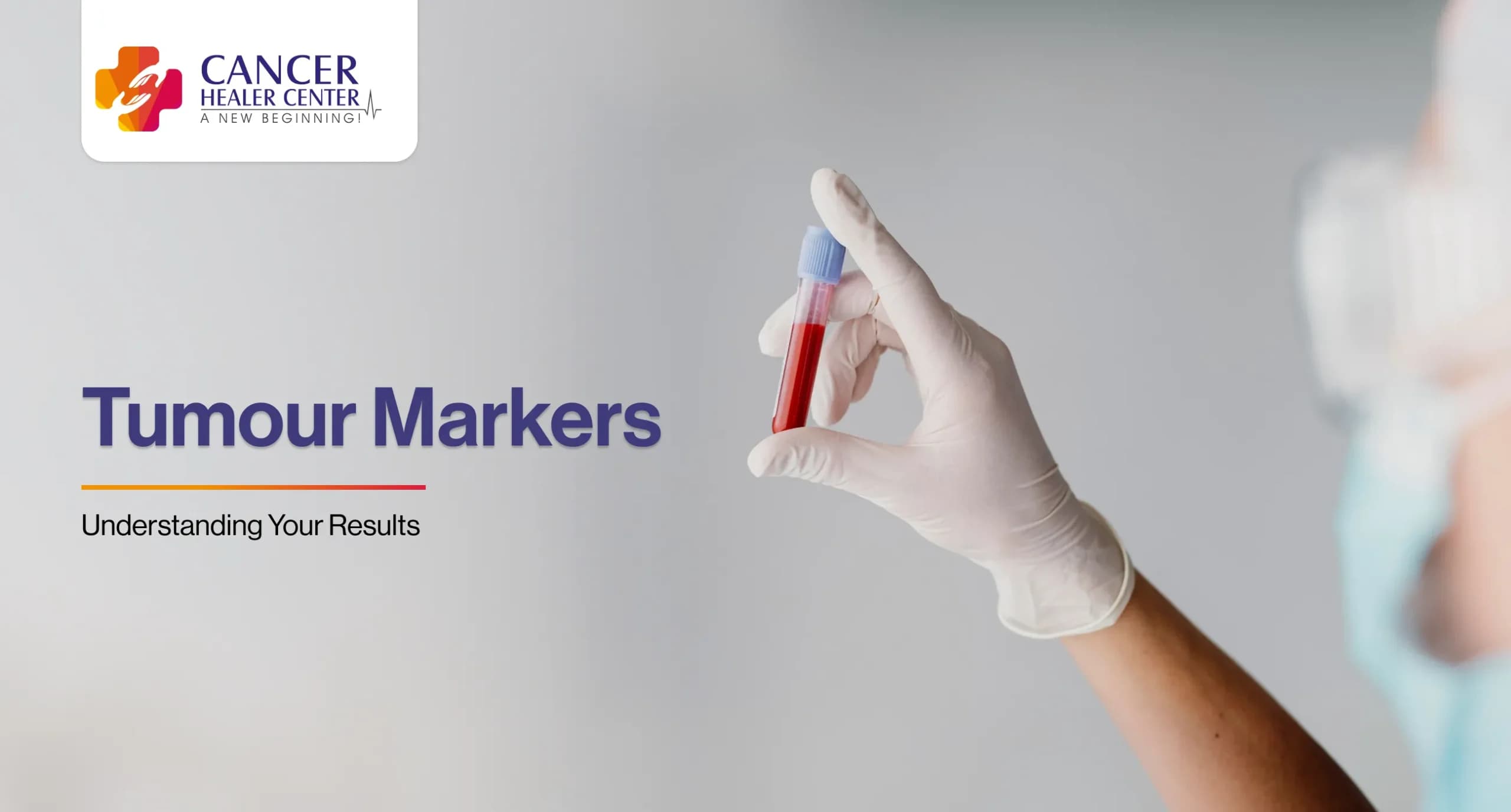 Tumour Markers Test – What Your Results Mean