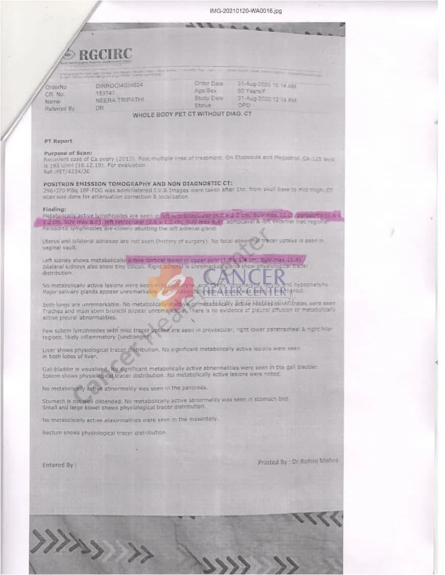 Recurrent Ovarian Carcinoma Case Study: Partial Response and Reduction in Metastatic Lymphadenopathy and Left Renal Lesion Documented on PET-CT — medical report 3