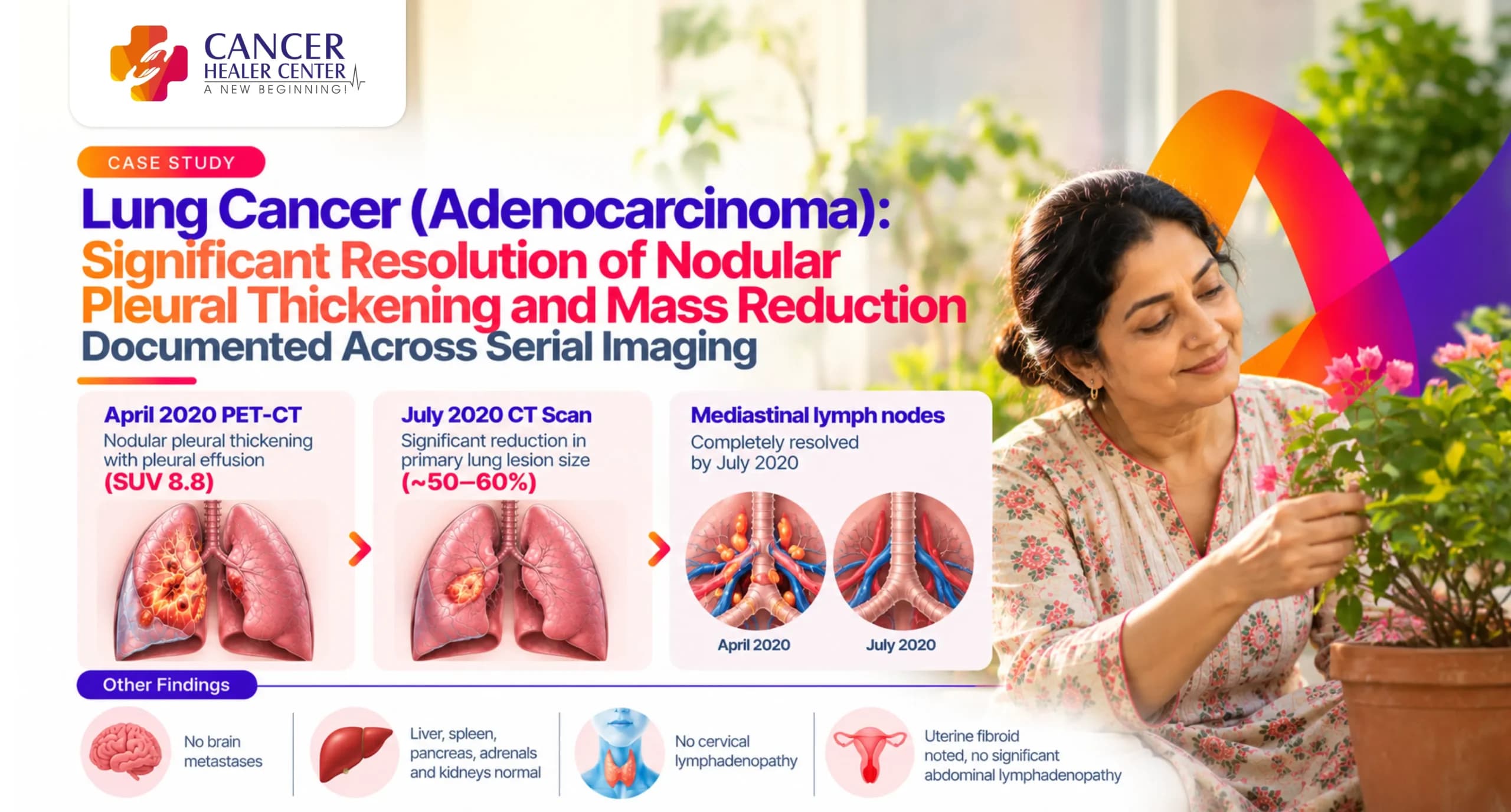 Lung Cancer (Adenocarcinoma) — Significant Resolution of Nodular Pleural Thickening and Mass Reduction Documented Across Serial Imaging