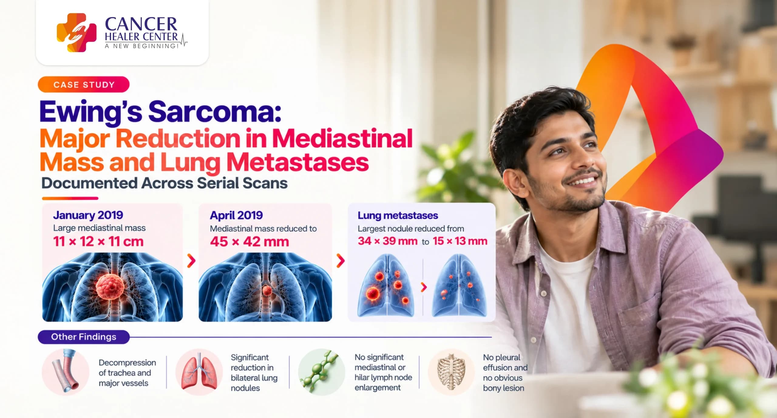 Ewing’s Sarcoma — Major Reduction in Mediastinal Mass Burden and Lung Metastases Documented Across Serial Scans