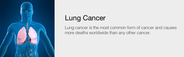 Smoking Is The Primary Cause Of Lung Cancer - Cancer Healer Center