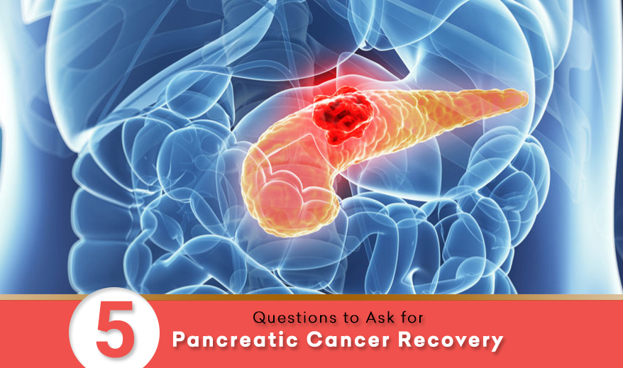 Immunotherapy For Pancreatic Cancer In India CancerWalls