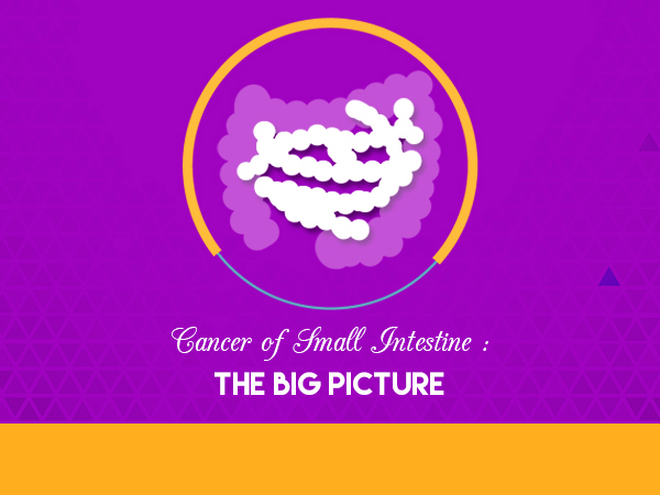 Cancer of Small Intestine : The Big Picture