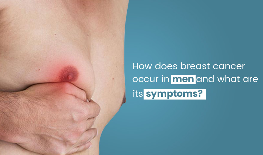 How does Breast Cancer occur in Men and what are its symptoms?