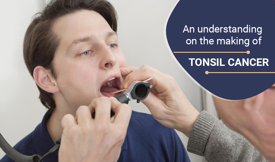 Oral Icon Tonsil Serum