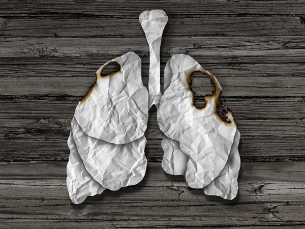 lung cancer diagnosis change your lifestyle