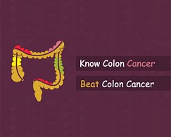Know Colon Cancer Beat Colon Cancer - Newsletter